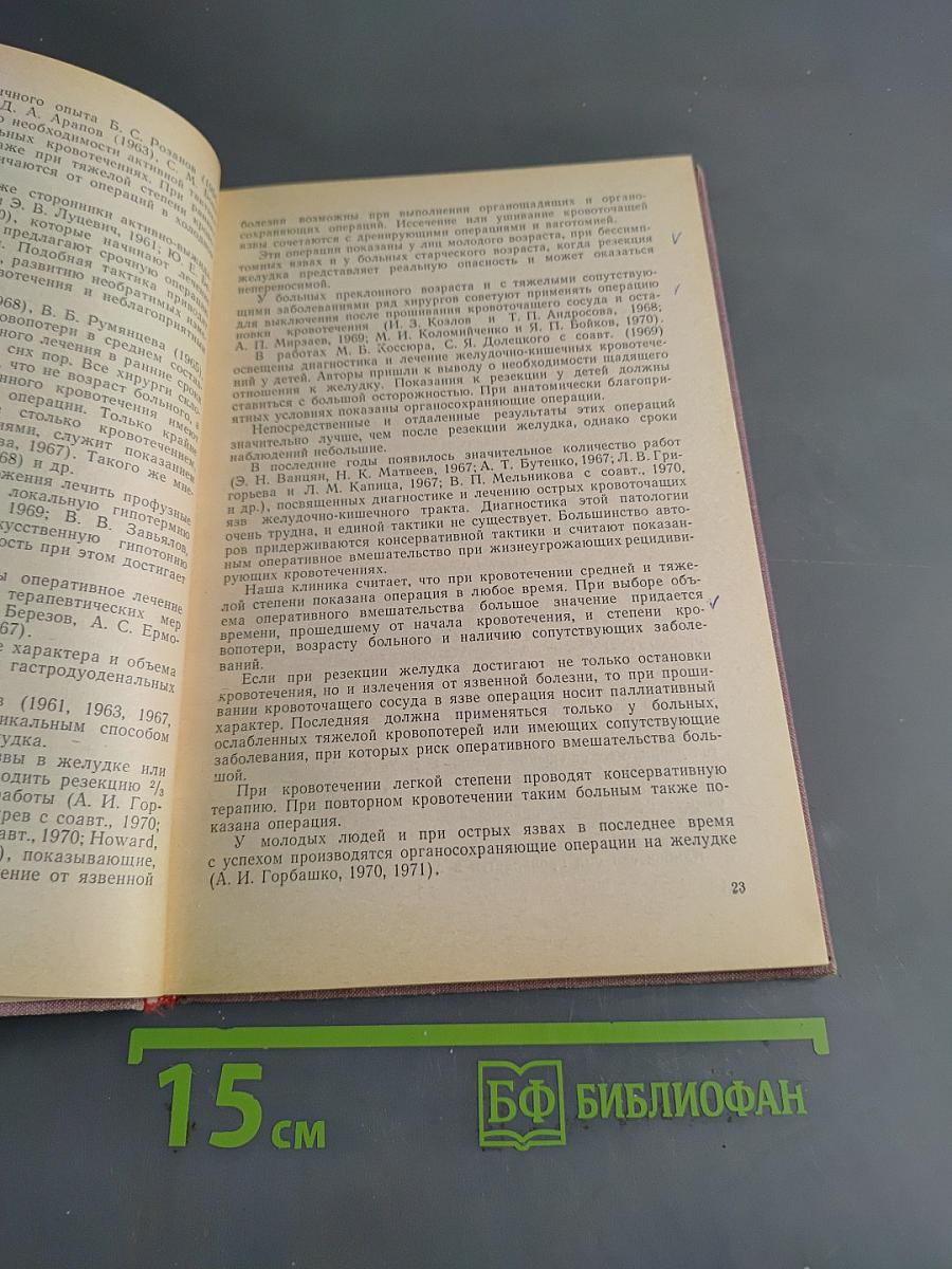 Резекция желудка