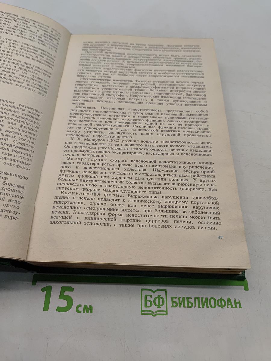 Болезни печени