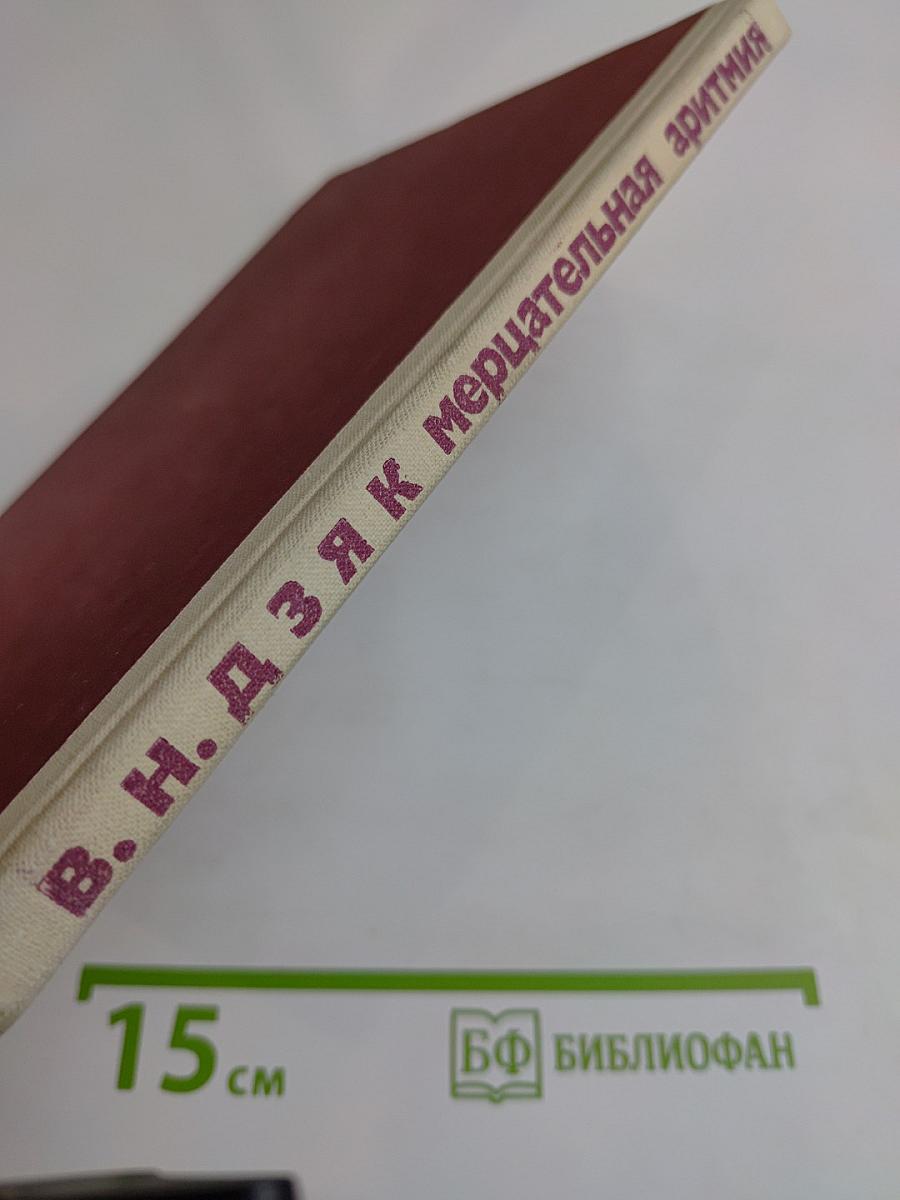 Мерцательная аритмия