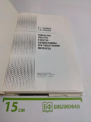 Изменения электро- и вектор-кардиограммы при гипертрофии миокарда