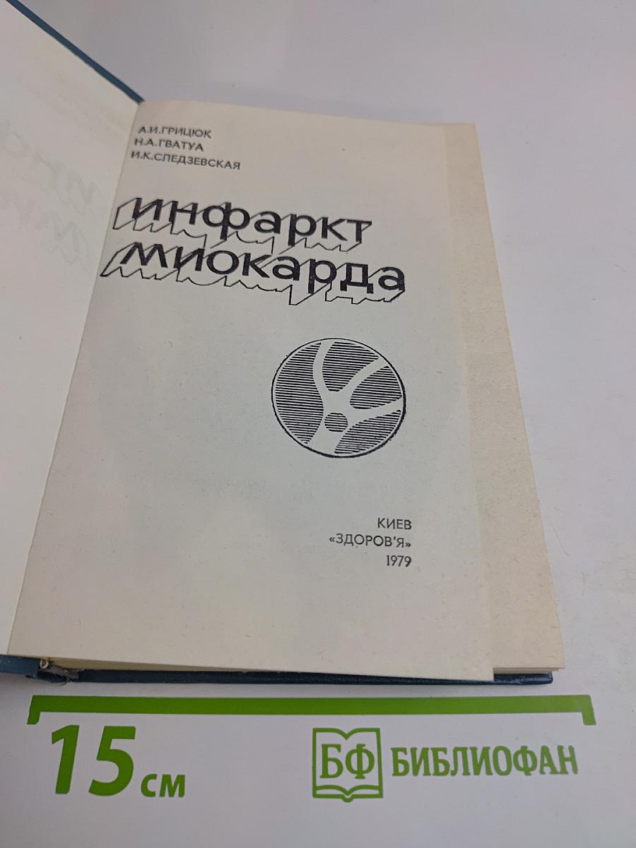 Инфаркт миокарда