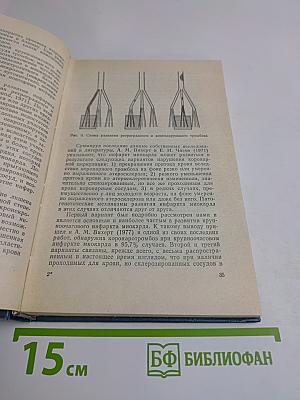 Инфаркт миокарда
