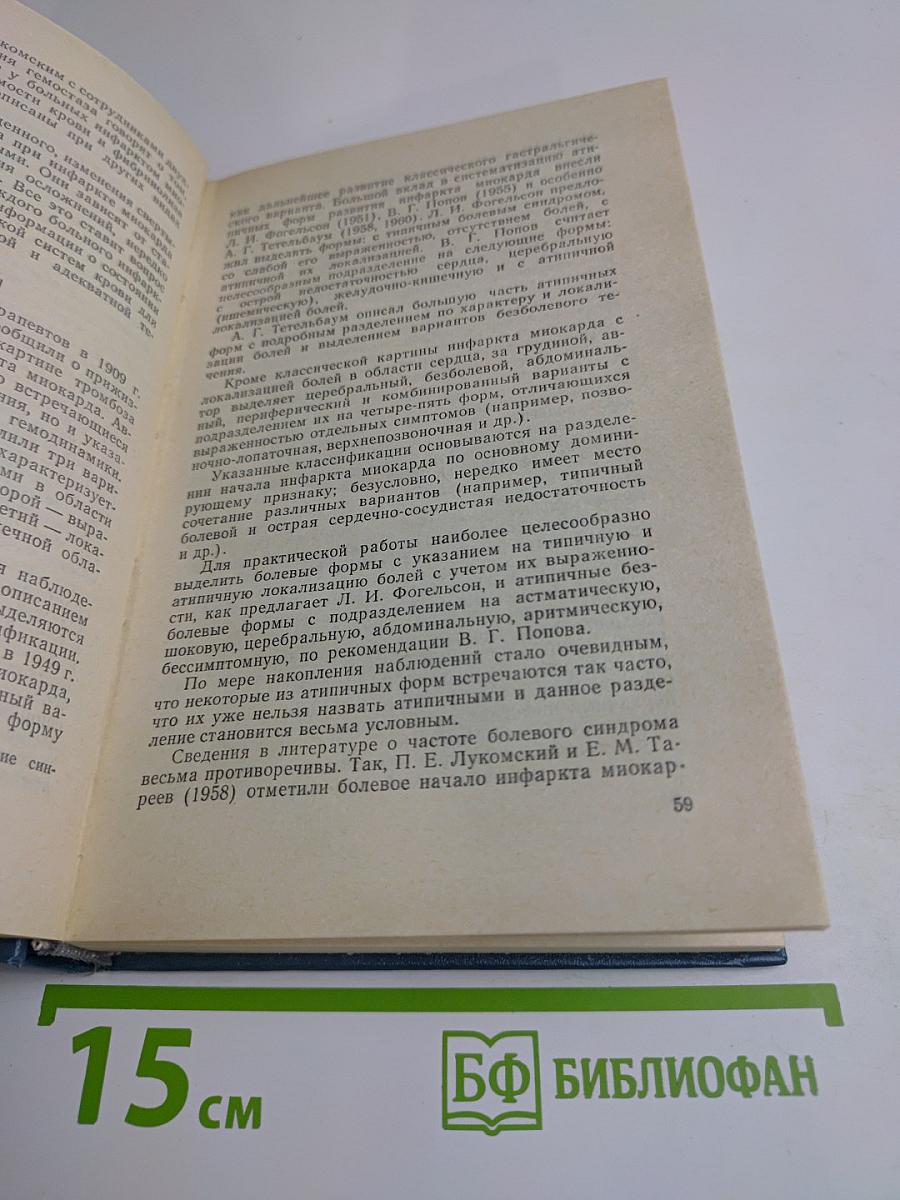 Инфаркт миокарда
