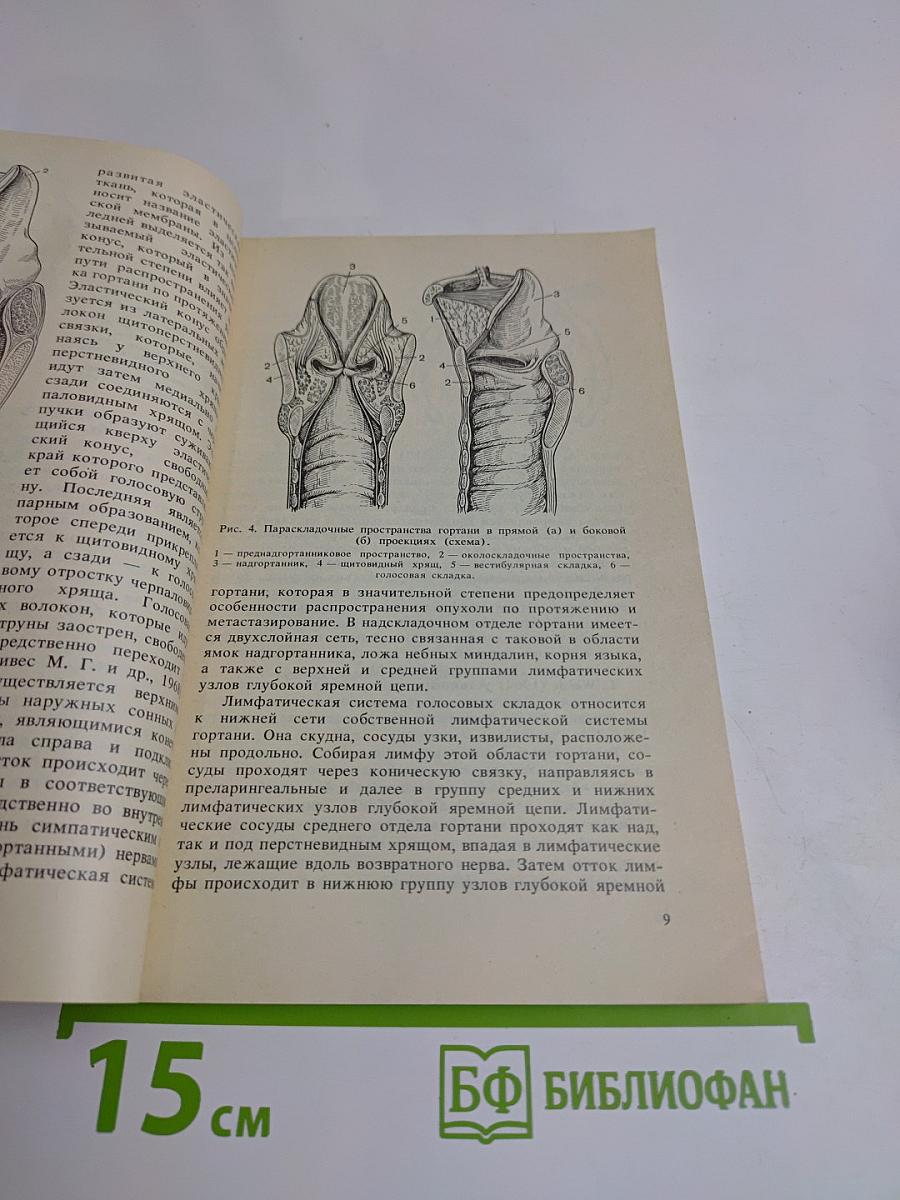 Диагностические и тактические ошибки при раке гортани