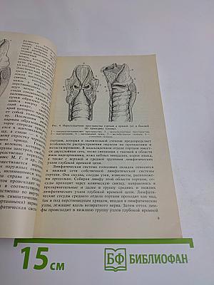 Диагностические и тактические ошибки при раке гортани