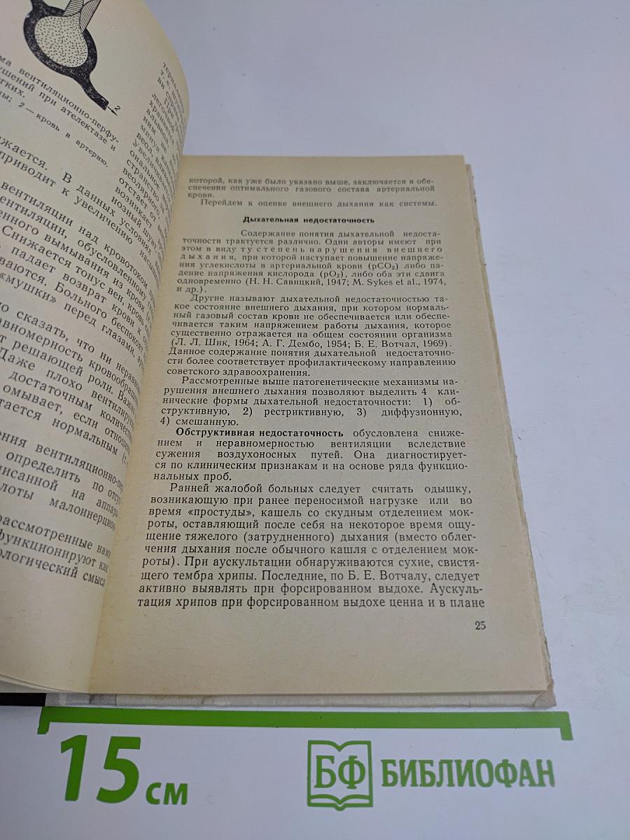 Легочно-сердечная недостаточность