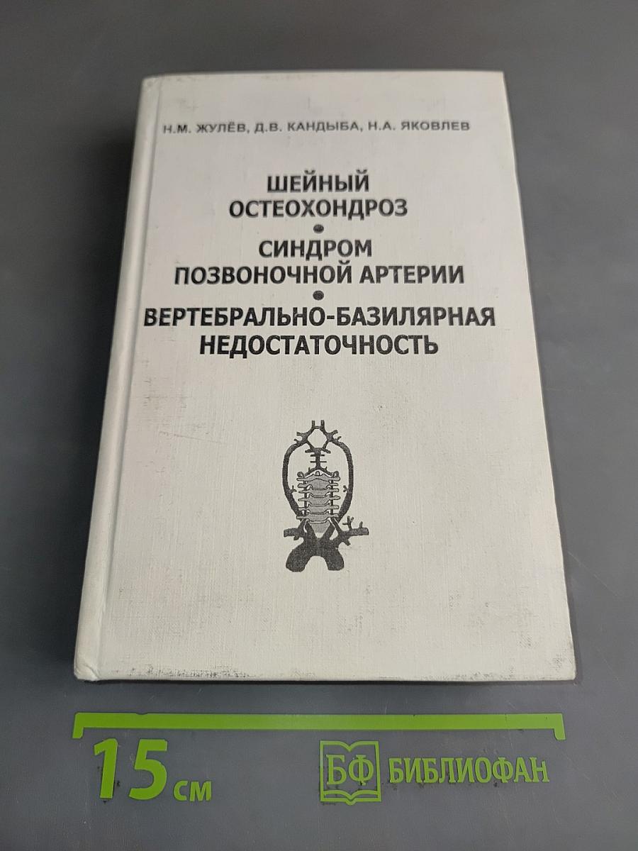 Шейный остеохондроз. Синдром позвоночной артерии. Вертебрально-базилярная недостаточность