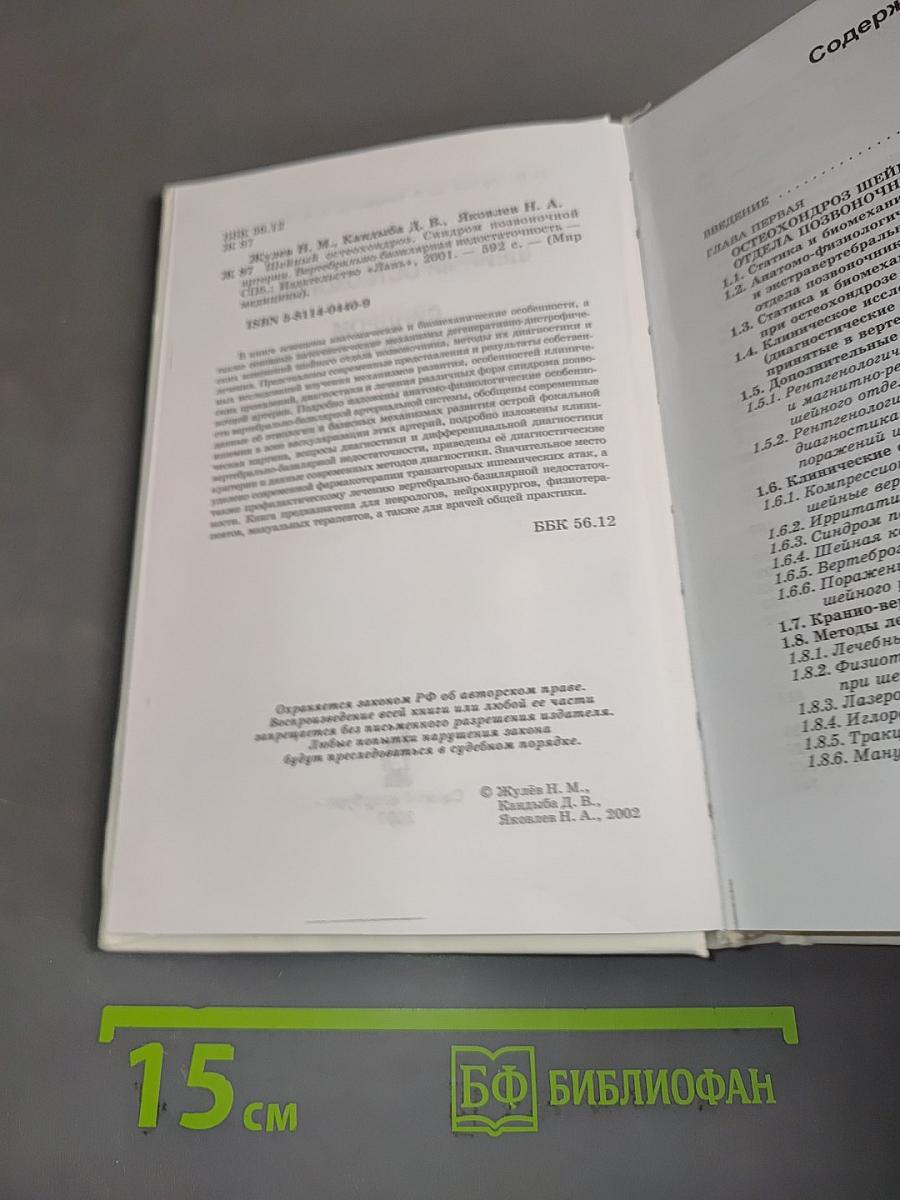 Шейный остеохондроз. Синдром позвоночной артерии. Вертебрально-базилярная недостаточность