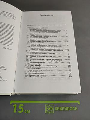 Шейный остеохондроз. Синдром позвоночной артерии. Вертебрально-базилярная недостаточность