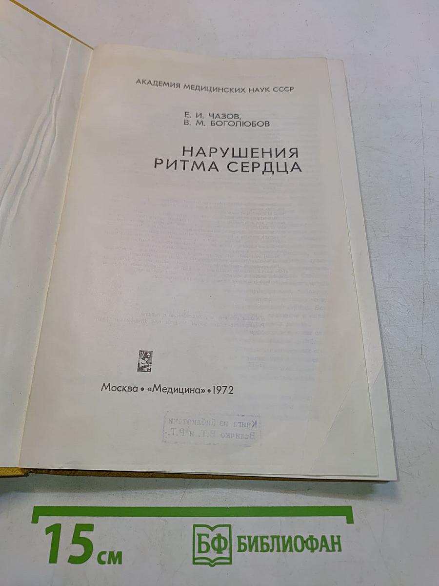 Нарушения ритма сердца