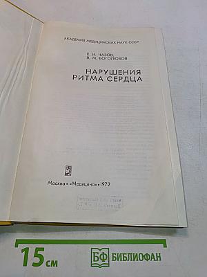 Нарушения ритма сердца