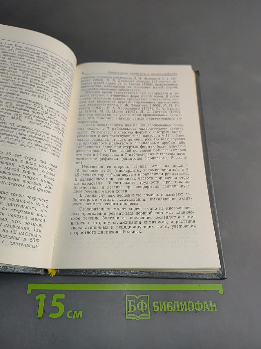Ревматические заболевания нервной системы
