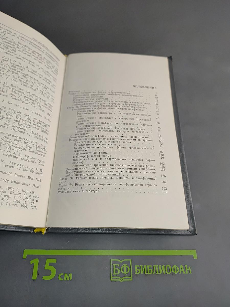 Ревматические заболевания нервной системы