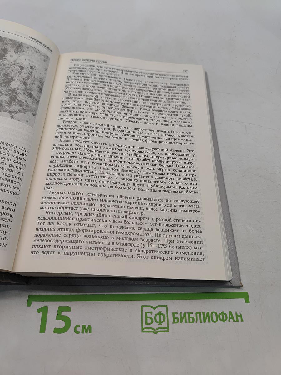 Болезни печени и почек