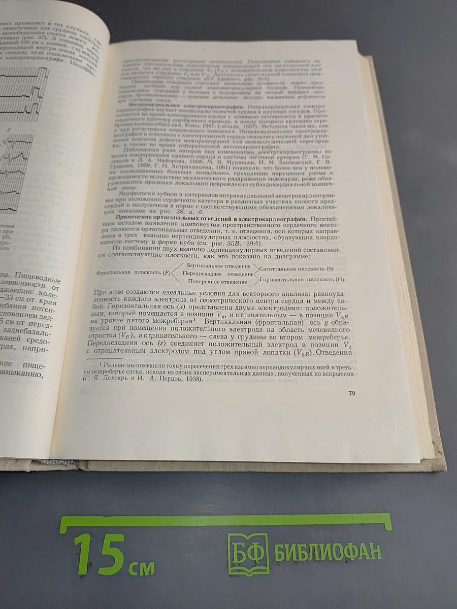 Электрокардиографическая диагностика