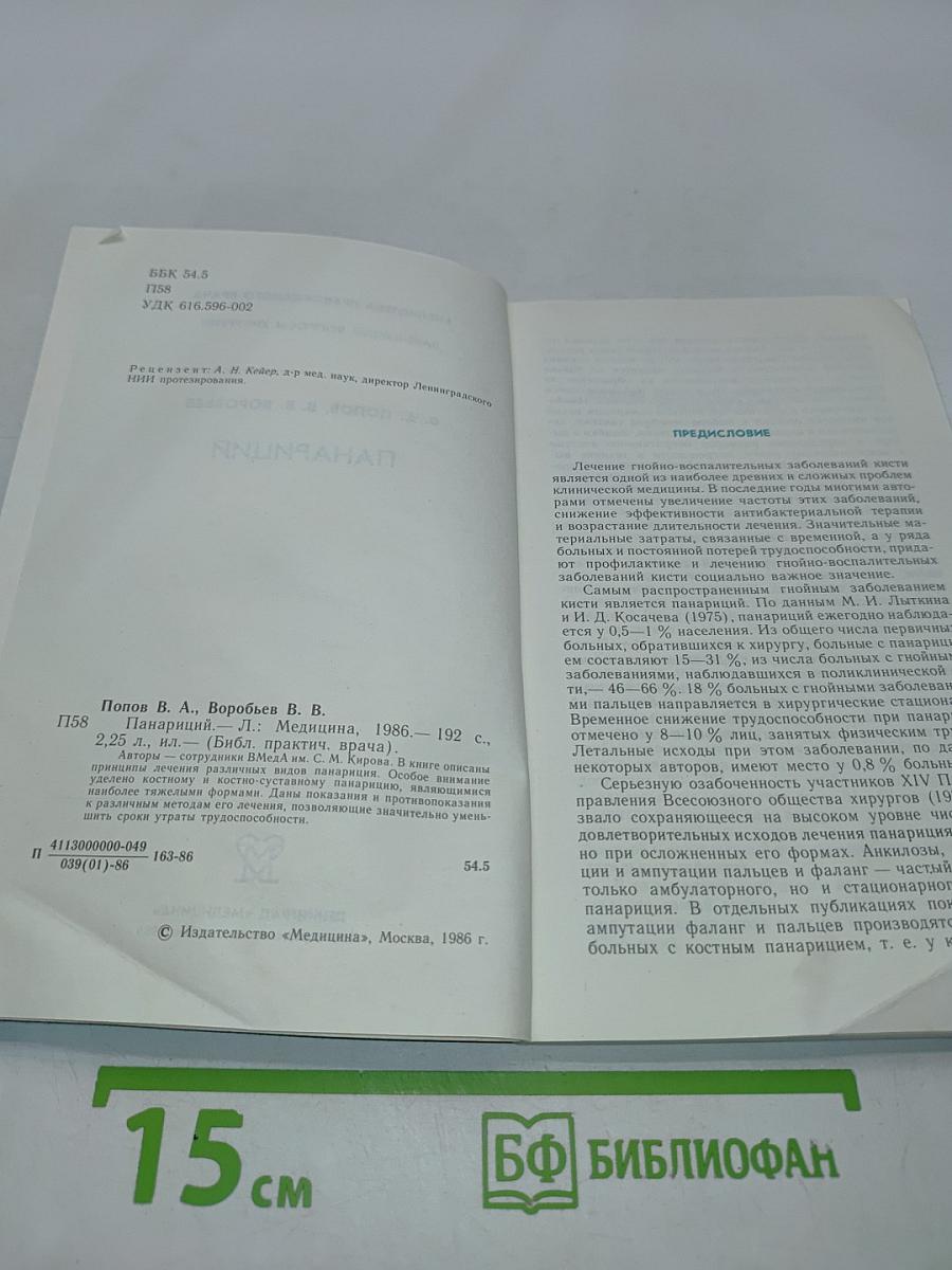 Панариций
