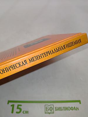 Инфаркт кишечника и хроническая мезентериальная ишемия
