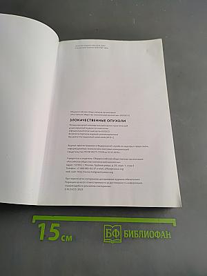 Злокачественные опухоли. Практические рекомендации Российского общества клинической онкологии. Часть 2