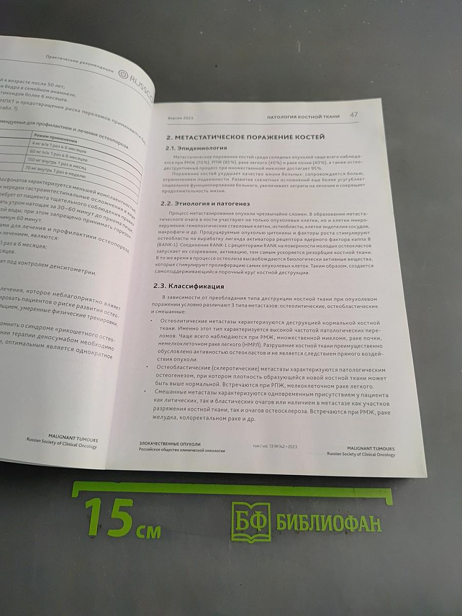 Злокачественные опухоли. Практические рекомендации Российского общества клинической онкологии. Часть 2