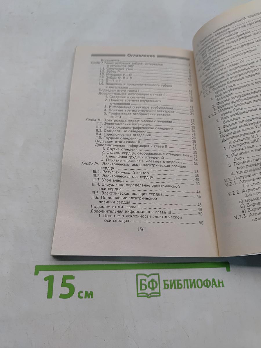 Азбука ЭКГ