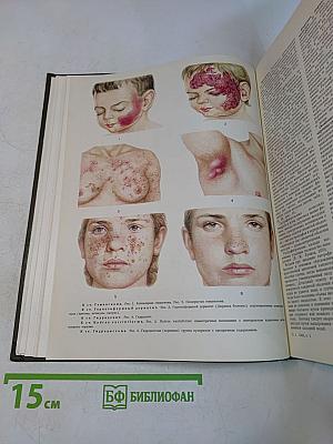 Большая медицинская энциклопедия. Том 5. Гамбузия-Гипотиазид