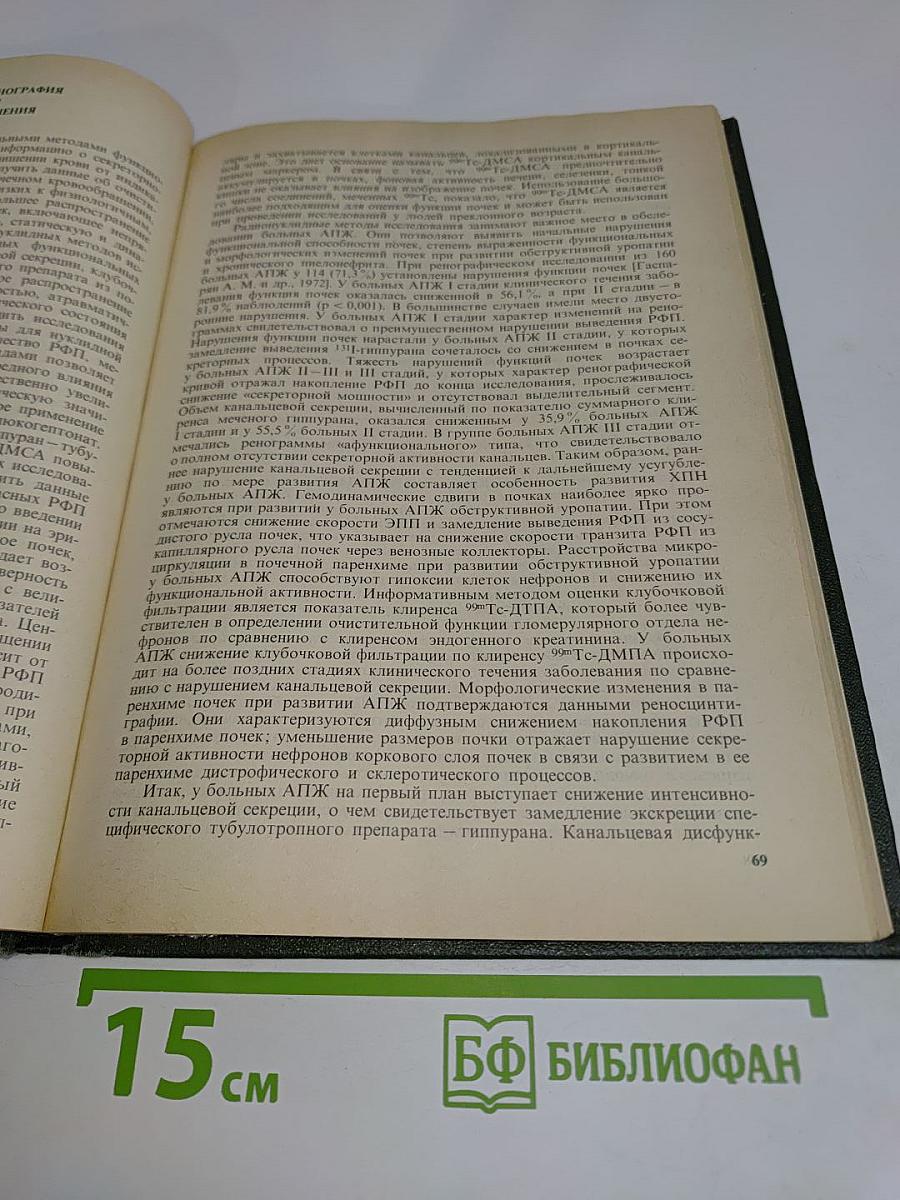 Хирургическое лечение аденомы и рака предстательной железы