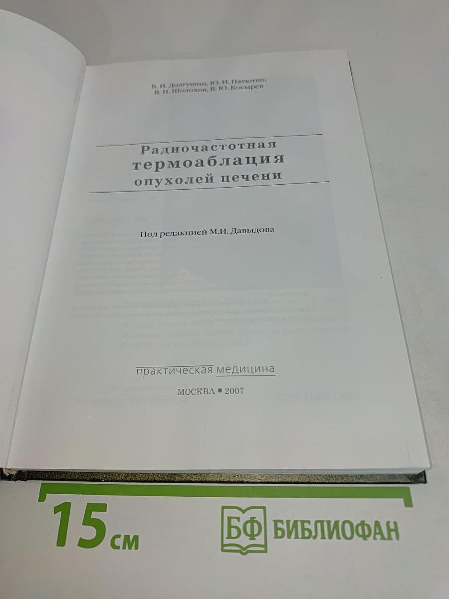 Радиочастотная термоабляция опухолей печени