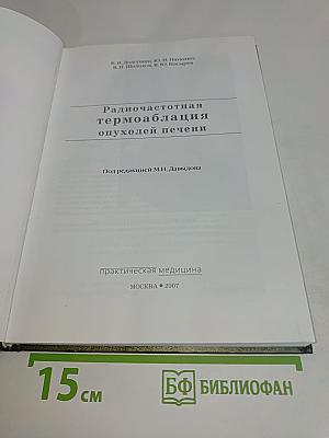 Радиочастотная термоабляция опухолей печени