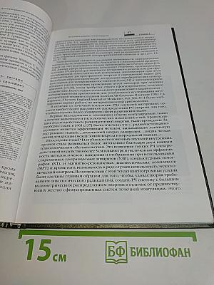 Радиочастотная термоабляция опухолей печени