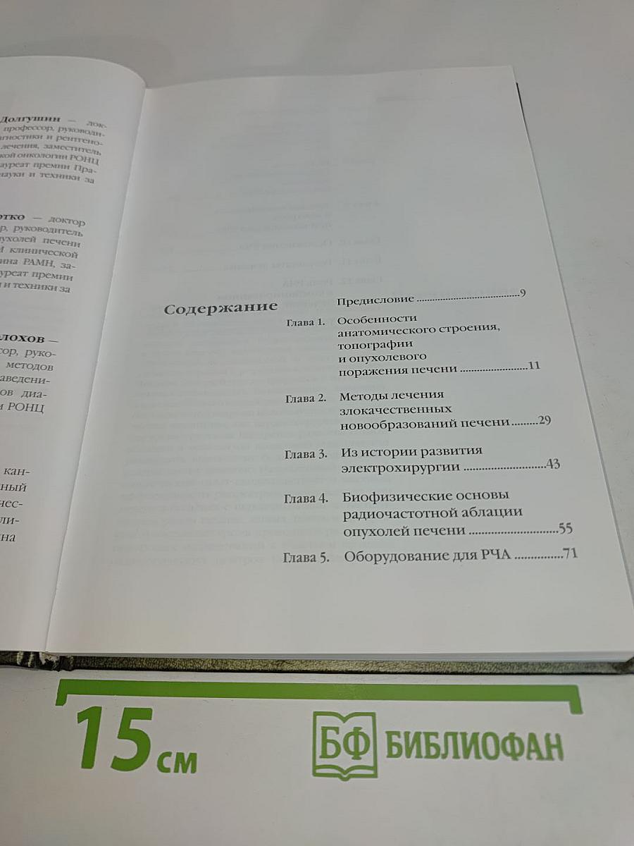 Радиочастотная термоабляция опухолей печени
