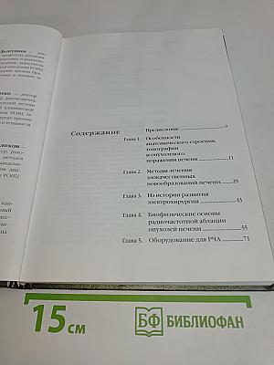 Радиочастотная термоабляция опухолей печени