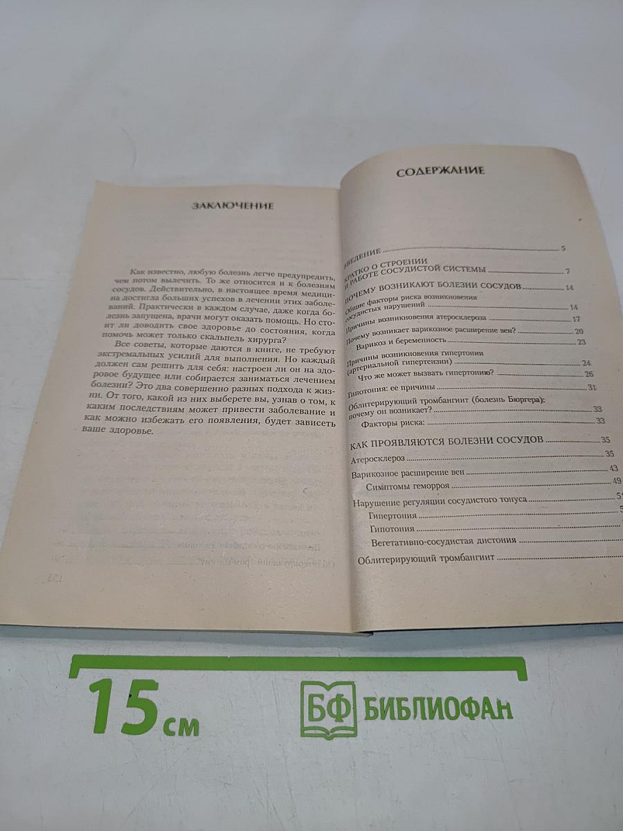 Болезни сосудов. Эффективное лечение и профилактика