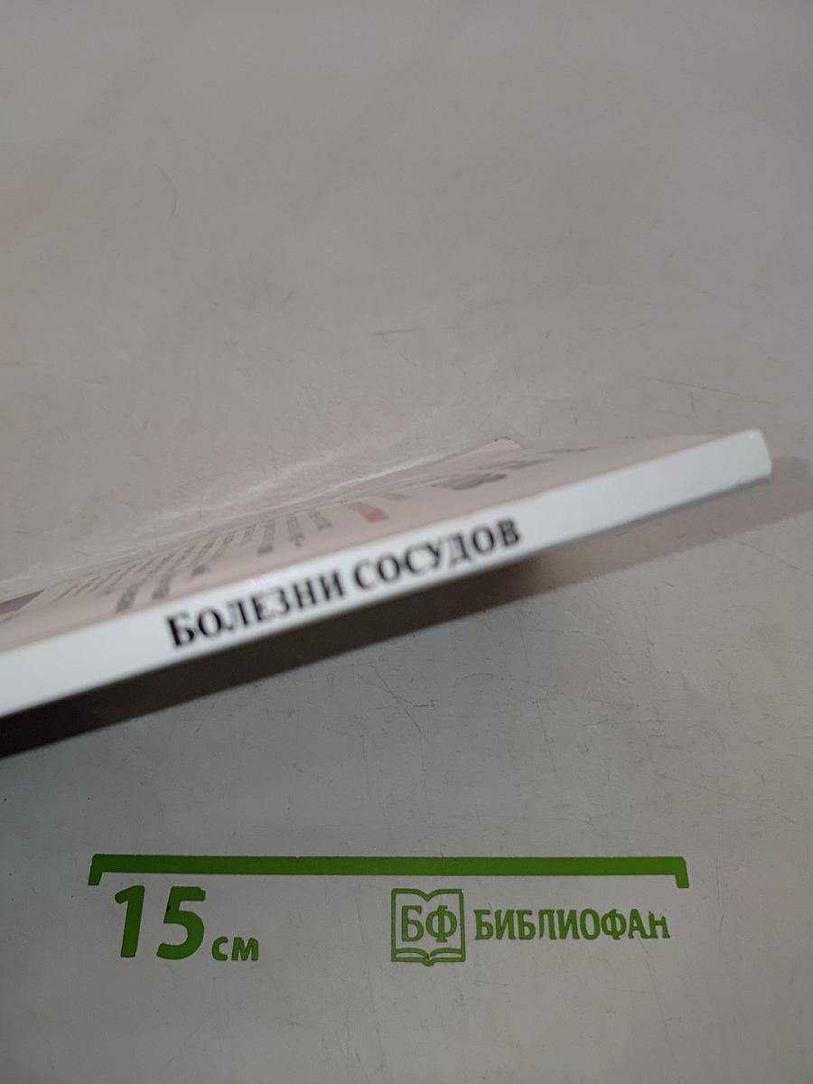 Болезни сосудов. Эффективное лечение и профилактика