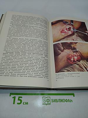 Операции при травмах опорно-двигательного аппарата (Атлас)