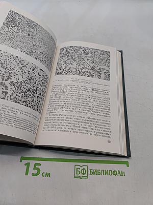 Тяжелые и злокачественные формы вирусного гепатита у детей