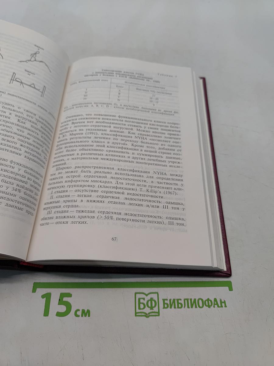 Хроническая застойная сердечная недостаточность. Идиопатические кардиомиопатии