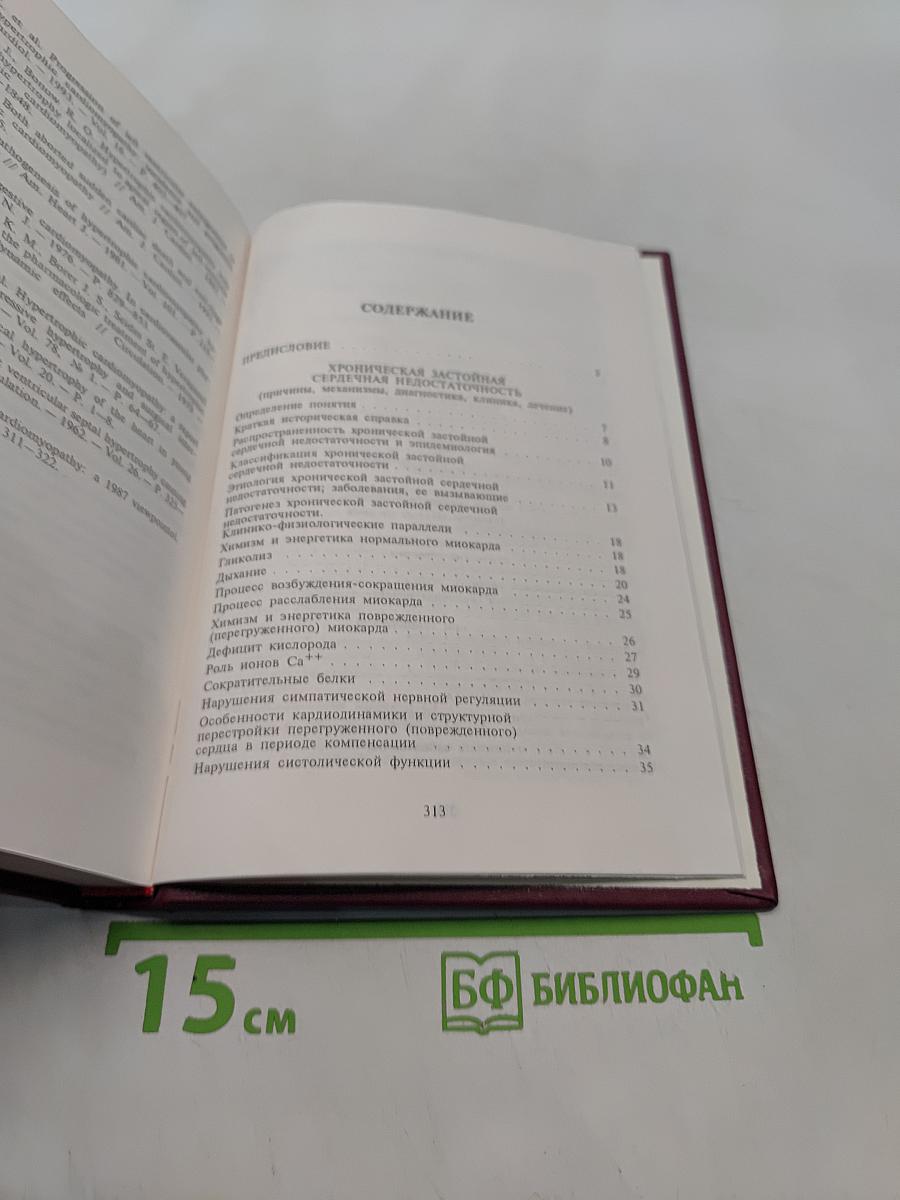 Хроническая застойная сердечная недостаточность. Идиопатические кардиомиопатии
