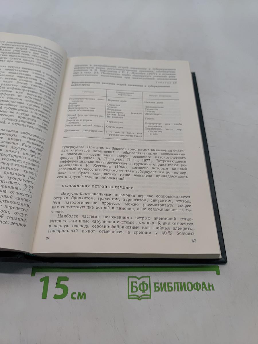 Болезни органов дыхания. Частная пульмонология. Том 2