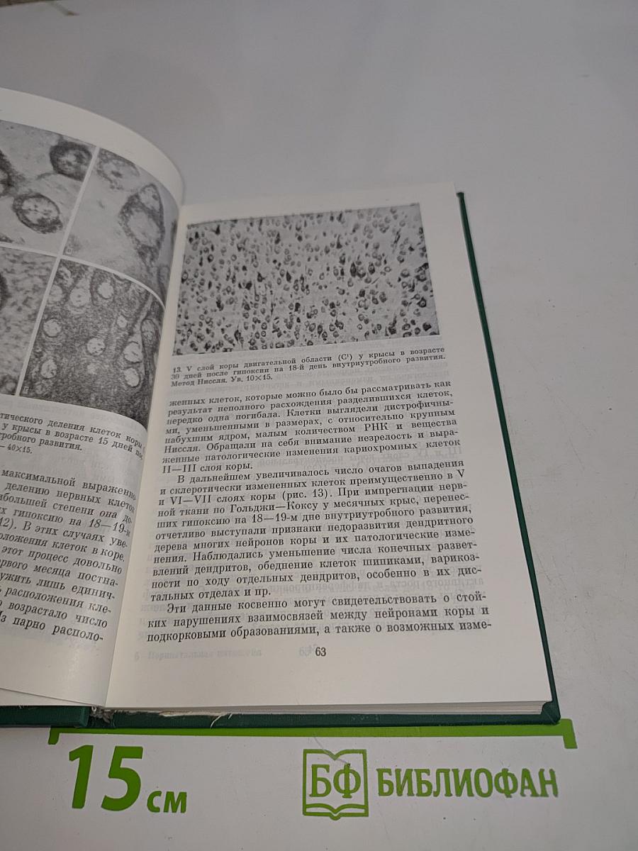 Перинатальная патология