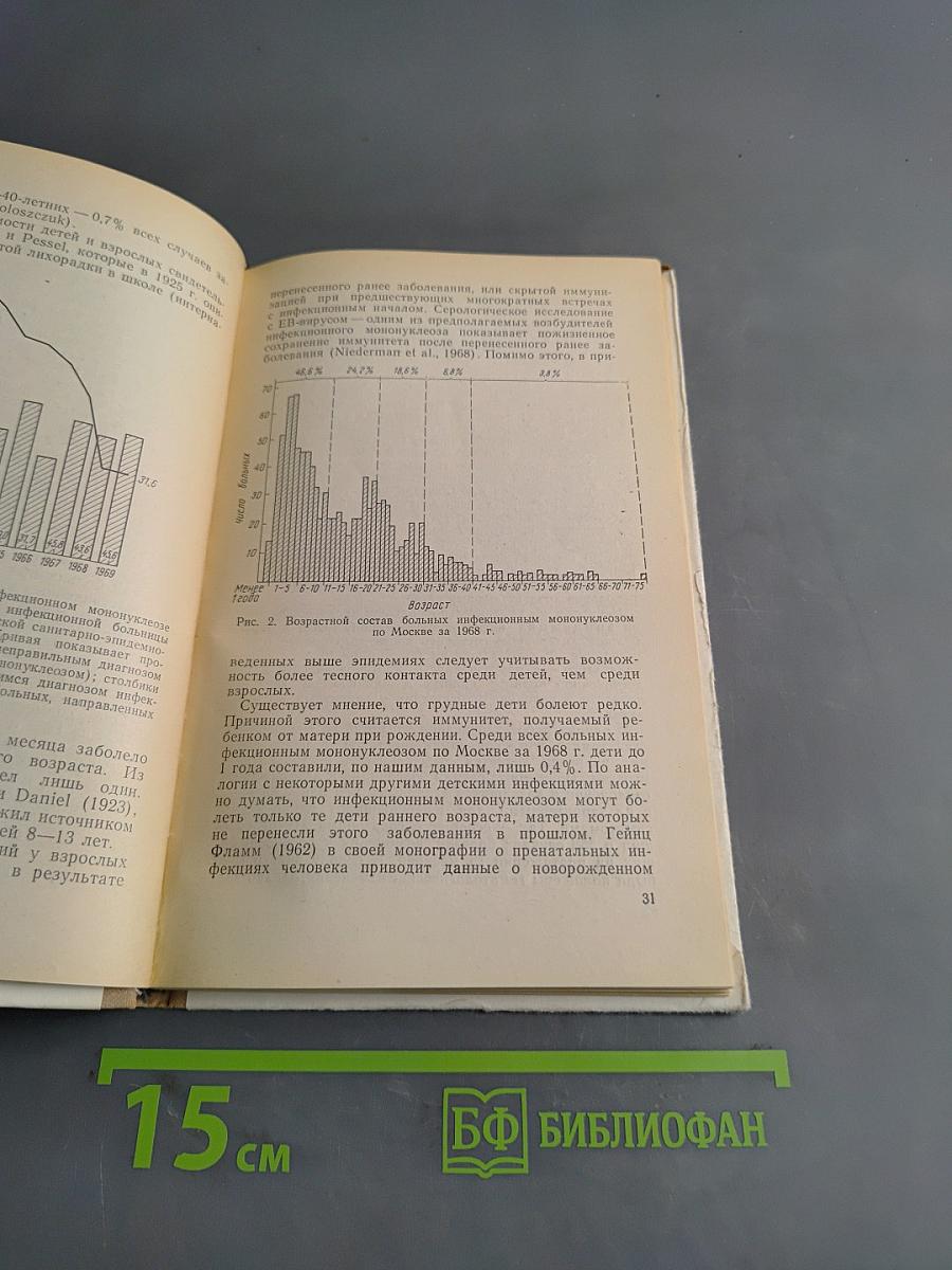 Инфекционный мононуклеоз у детей