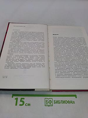 Хирургия острых мозговых инсультов