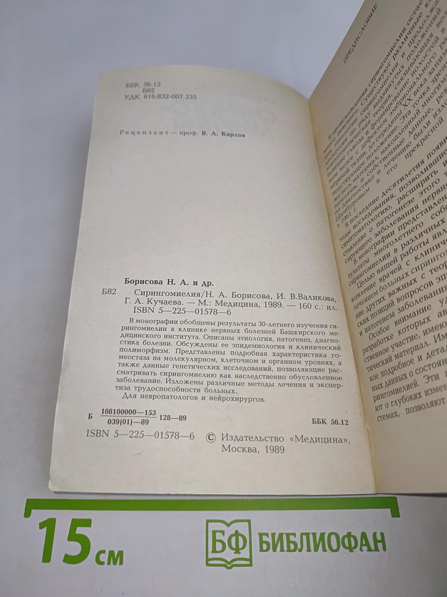 Сирингомиелия