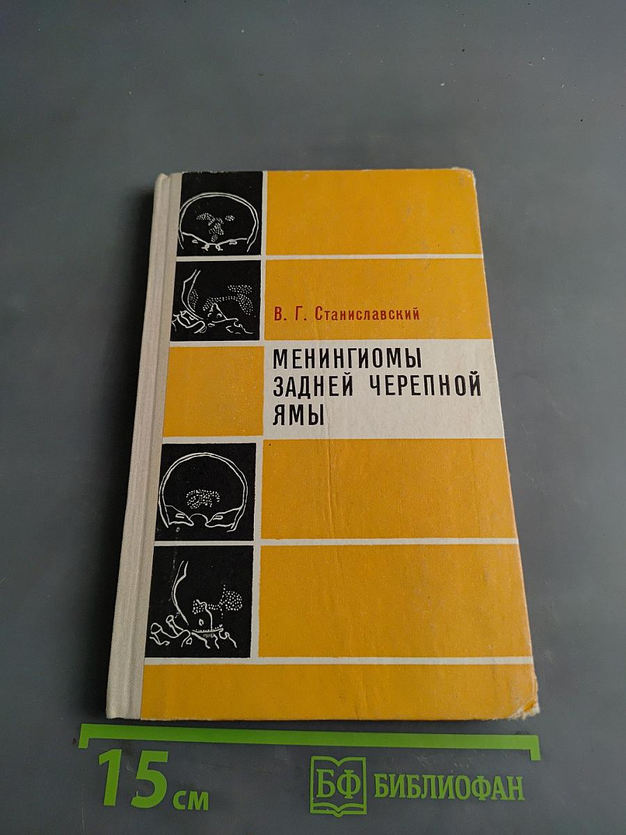 Менингиомы задней черепной ямы
