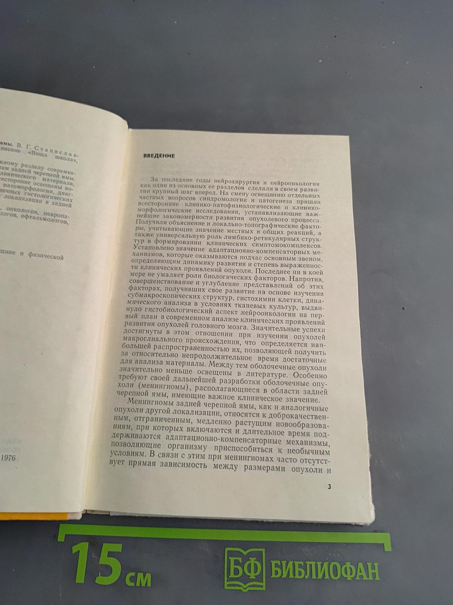 Менингиомы задней черепной ямы