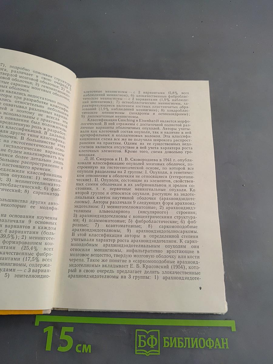 Менингиомы задней черепной ямы