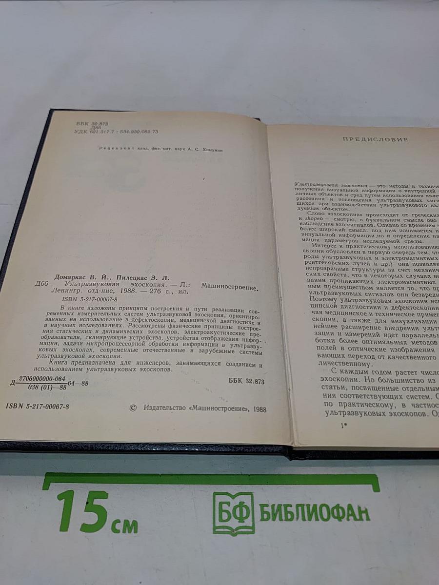 Ультразвуковая эхоскопия