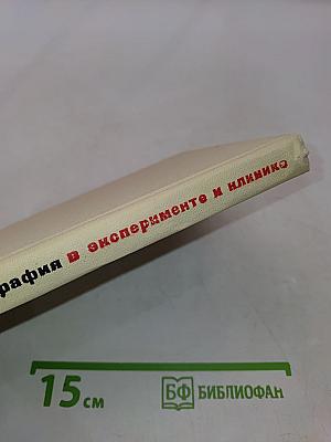 Ангиотензотонография в эксперименте и клинике. Ранняя диагностика сосудистых заболеваний