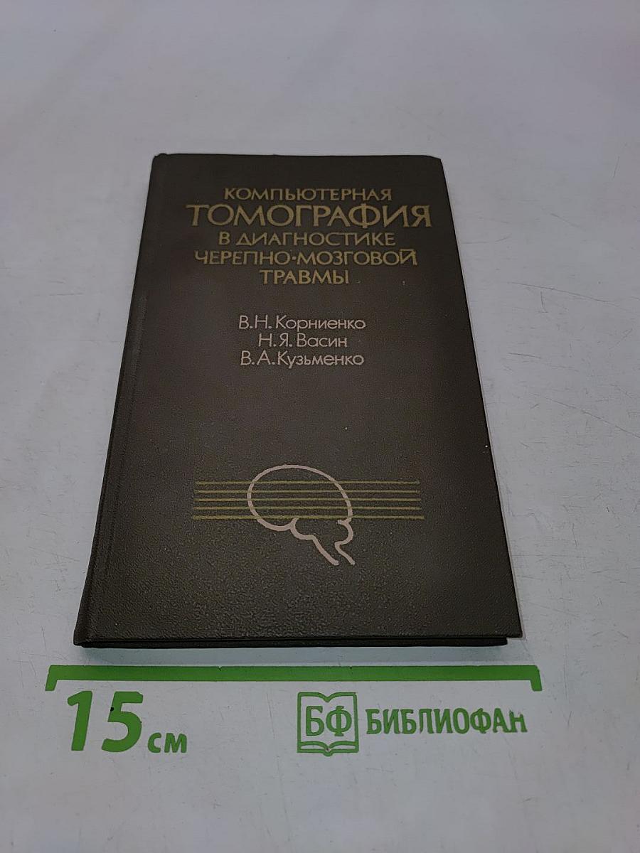 Компьютерная томография в диагностике черепно-мозговой травмы