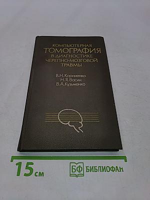 Компьютерная томография в диагностике черепно-мозговой травмы