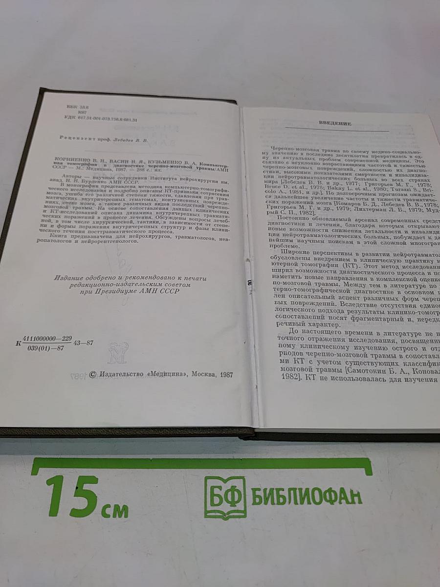 Компьютерная томография в диагностике черепно-мозговой травмы
